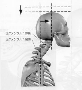 頭部前方移動は下部頸椎過屈曲上部頸椎過伸展