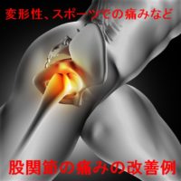 股関節の痛み改善症例報告ページ