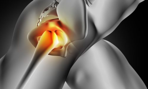 股関節の痛み改善症例報告ページ
