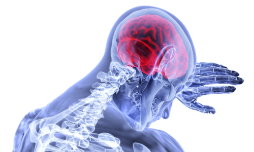 外傷が脳活性化領域に影響